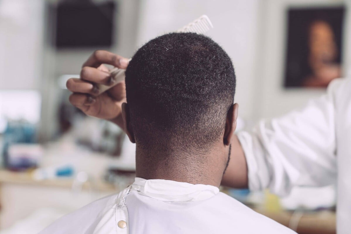 can phone radiation cause hair loss?
